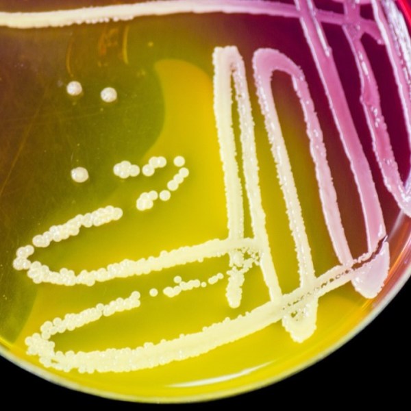 Waarom wetenschappers GGO’s maken voor onderzoek in het&nbsp;laboratorium