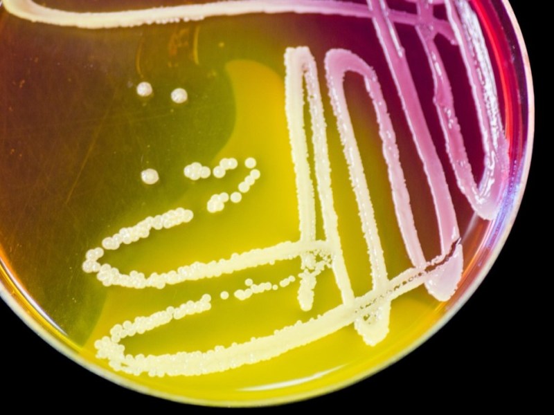 Why scientists need to create GMOs for their research in the&nbsp;lab